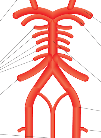 Osteopathy: Acute Peripheral Arterial Occlusion