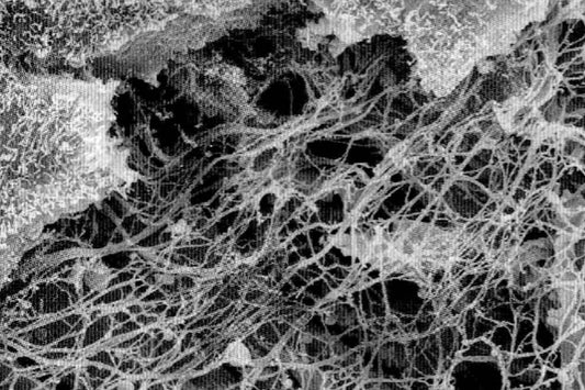 Elastin, an Essential Protein Related to Mobility Osteopathybooks