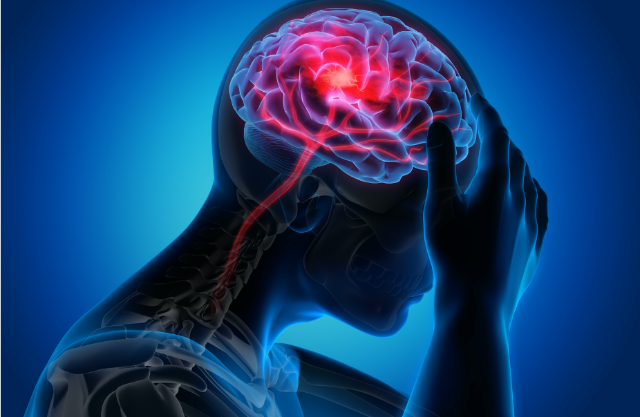 The Scientific Osteopathic Approach To Patients With Headache