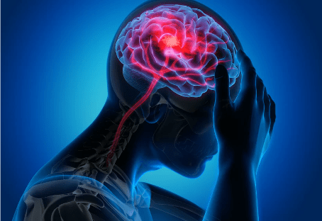 The Scientific Osteopathic Approach To Patients With Headache Course
