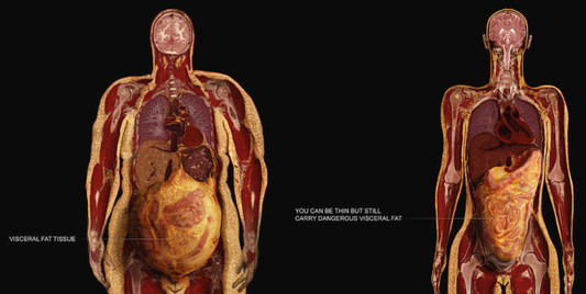 The metabolic syndrome is a condition of chronic low-grade inflammation Osteopathybooks