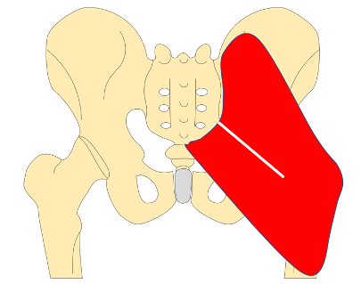 Muscular Separation in the Gluteus Maximus Muscle