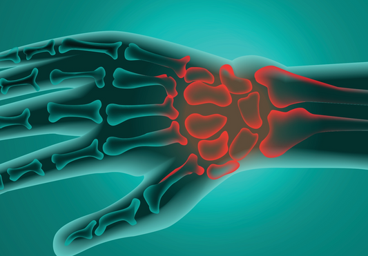 The role of the microbiome in rheumatoid arthritis