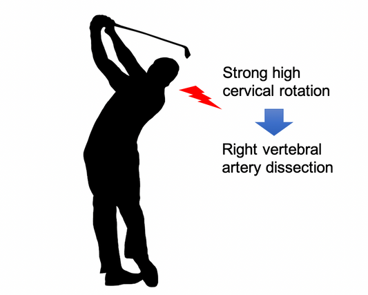Osteopathy; golfers' stroke