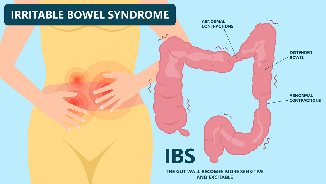 Osteopathy: Risk factors that may trigger Irritable Bowl Syndrome (IBS)