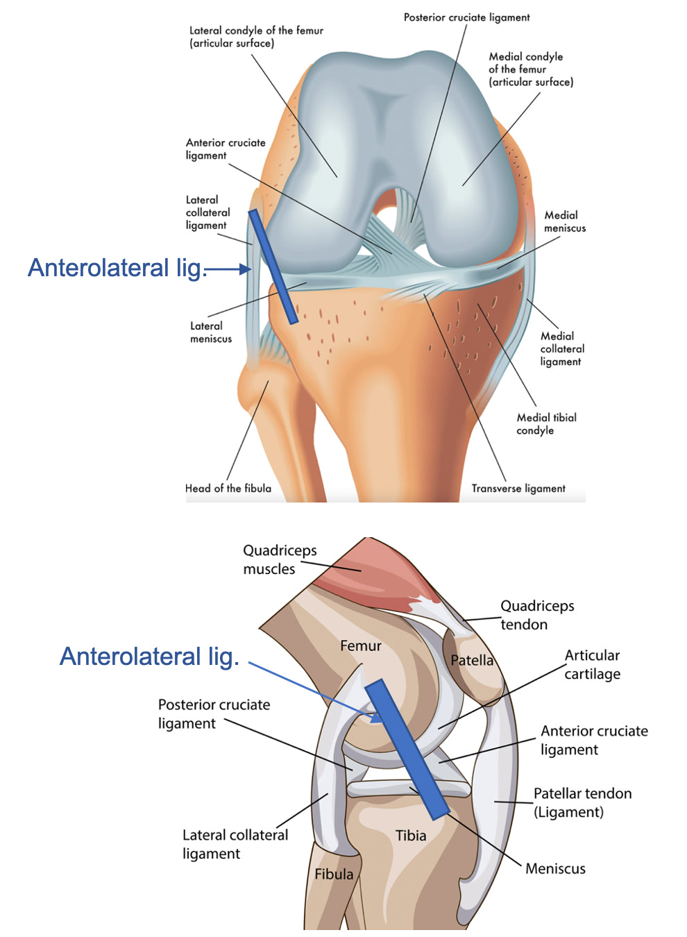 Anterolateral ligament of the knee Osteopathybooks