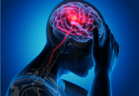 The Scientific Osteopathic Approach To Patients With Headache Course Thinkific 