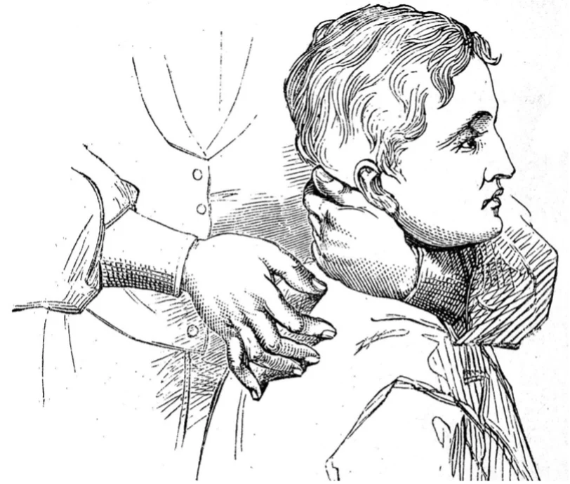 Some facts about the history of spinal manipulation